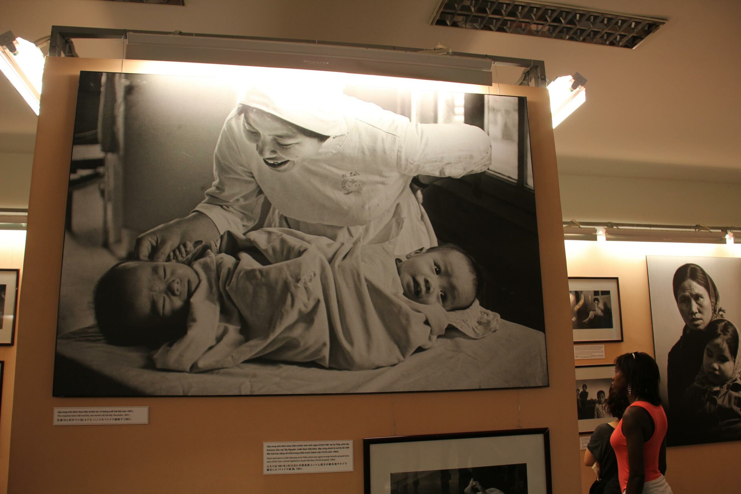 Photographs show birth defects allegedly caused by American use of the defoliant Agent Orange in the Ho Chi Minh City War Remnants Museum.